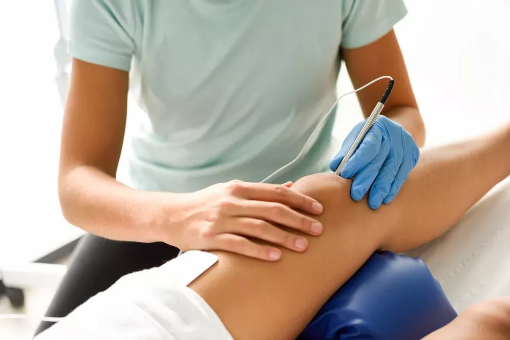 electroacupuncture-dry-with-needle-female-knee